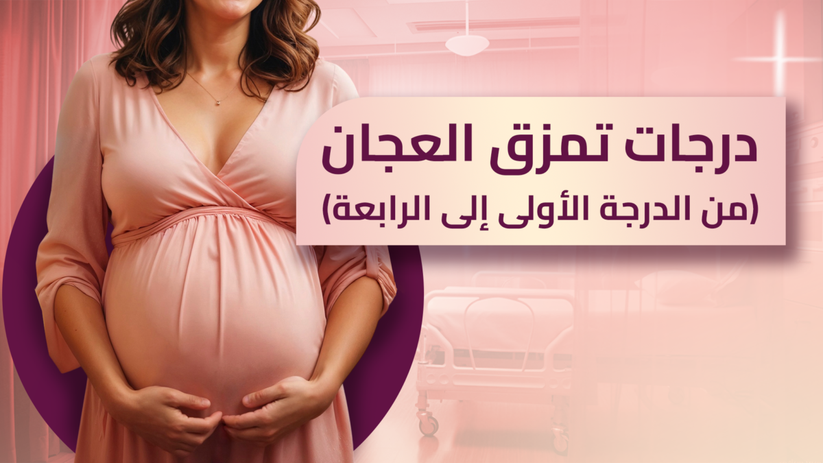 درجات-تمزق-العجان-من-الدرجة-الأولى-إلى-الرابعة-copy-1200x675.png